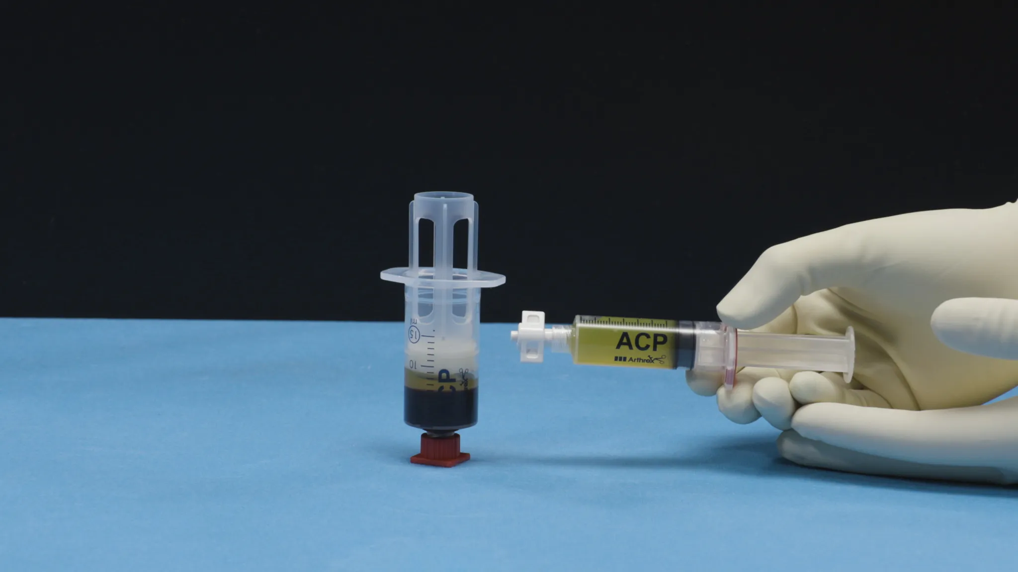 Čo je ACP Arthrex a liečba vlastnou plazmou?